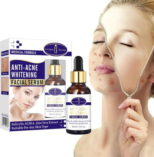 AICHUN BEAUTY Anti-Acne Facial Serum Aloe Vera Extract Salicylic Acid Repairs Damaged Skin 30ml - Sahara Nest
